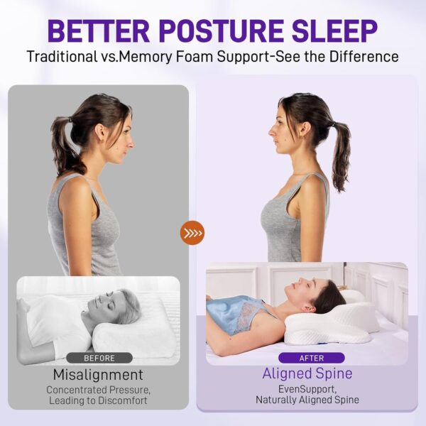 Cervical Neck Pillow for Sleeping, Cervical Pillow for Neck Pain Relief, Hollow Design, - Image 3