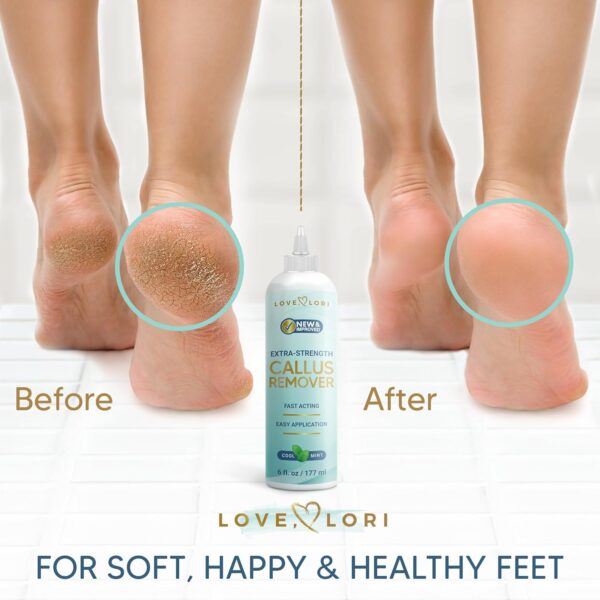 Callus Remover for Feet (Extra Strength) Professional Foot Scrubber Dead Skin Callus Gel - Image 2